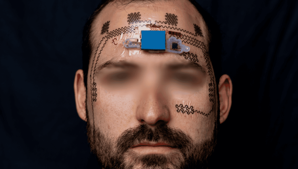 Primer plano de un hombre con un dispositivo electrónico experimental adherido a su frente, conectado mediante sensores flexibles que se extienden por el rostro, en un entorno de fondo negro. Primer plano de un hombre con un dispositivo electrónico experimental adherido a su frente, conectado mediante sensores flexibles que se extienden por el rostro, en un entorno de fondo negro.