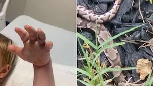Copperhead snake bites youngster at daycare, 911 not contacted Copperhead snake bites youngster at daycare, 911 not contacted