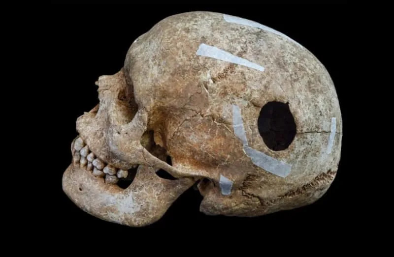 Cambridge college students discover burial pit, ninth century ‘large’ who underwent surgical procedure throughout coaching dig Cambridge college students discover burial pit, ninth century ‘large’ who underwent surgical procedure throughout coaching dig