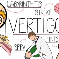Vertigo Made Easy – Causes, Symptoms and Treatment Vertigo Made Easy – Causes, Symptoms and Treatment