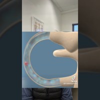 What’s the main causes of vertigo? #vertigo #chiropractor #wellbeing #anatomy What’s the main causes of vertigo? #vertigo #chiropractor #wellbeing #anatomy