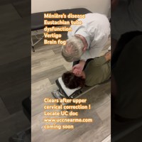Ménière’s disease, Eustachian tube dysfunction, vertigo, and brain fog healed with upper cervical ! Ménière’s disease, Eustachian tube dysfunction, vertigo, and brain fog healed with upper cervical !