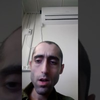 ENT – Meniere and caloric test ENT – Meniere and caloric test