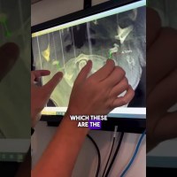 Vertigo, Dizziness, Tinnitus Vertigo, Dizziness, Tinnitus