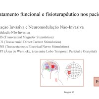 Zumbido curso online 3 Zumbido curso online 3