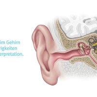 Wodurch wird ein Hörverlust verursacht? Wodurch wird ein Hörverlust verursacht?