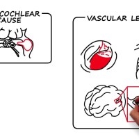 Ear, Nose, and Throat – Tinnitus: By Carol Bauer M.D. Ear, Nose, and Throat – Tinnitus: By Carol Bauer M.D.