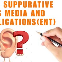 ACUTE SUPURATIVE OTITIS MEDIA AND OTITIC BAROTRAUMA ACUTE SUPURATIVE OTITIS MEDIA AND OTITIC BAROTRAUMA