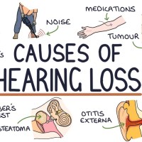 Understanding the Causes of Hearing Loss Understanding the Causes of Hearing Loss