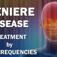 Meniere Disease – RIFE Frequencies Treatment – Energy & Quantum Medicine with Bioresonance Meniere Disease – RIFE Frequencies Treatment – Energy & Quantum Medicine with Bioresonance