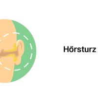 Hörsturz – Erkrankungen der Ohren (mit Infoleiste) Hörsturz – Erkrankungen der Ohren (mit Infoleiste)