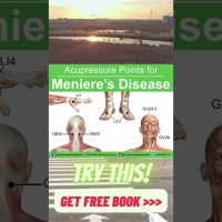Acupressure Points for Meniere’s Disease #shorts #acupressure #menieresdisease #menieres #selfcare Acupressure Points for Meniere’s Disease #shorts #acupressure #menieresdisease #menieres #selfcare