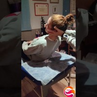 Test Dix-Hallpike para vértigo posicional paroxístico benigno por afectación de canales posteriores Test Dix-Hallpike para vértigo posicional paroxístico benigno por afectación de canales posteriores