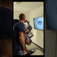 Vertige positionnel paroxystique bénin du canal postérieur droit manoeuvré sous assistance mécanique Vertige positionnel paroxystique bénin du canal postérieur droit manoeuvré sous assistance mécanique