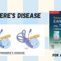 MENIERE’S DISEASE #aiapget #bhms #homoeopathy MENIERE’S DISEASE #aiapget #bhms #homoeopathy
