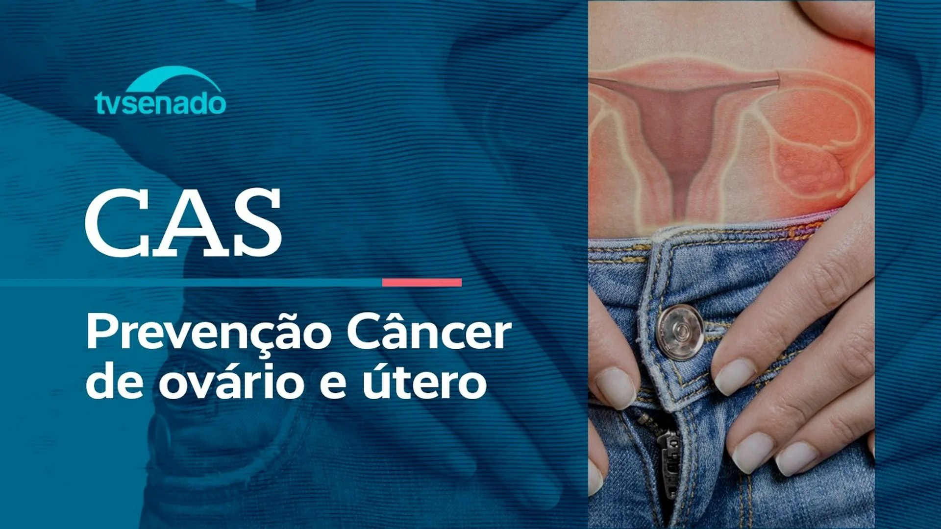 CAS debate atenção ao câncer de colo do útero – 5/5/26 — Senado Notícias CAS debate atenção ao câncer de colo do útero – 5/5/26 — Senado Notícias