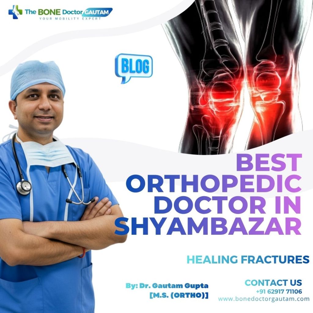 Best Orthopedic doctor in Shyambazar, Kolkata: Dr. Gautam Gupta Best Orthopedic doctor in Shyambazar, Kolkata: Dr. Gautam Gupta
