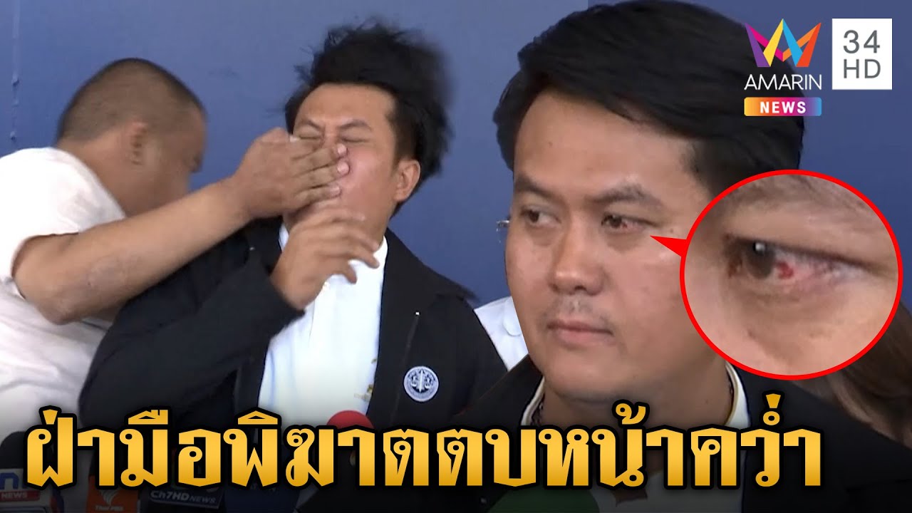 เปิดนาทีหนุ่มบุกตบปาก “ทนายธรรมราช” ยันไม่ได้มีความแค้น | ข่าวเย็นอมรินทร์ | 1 พ.ย. 67 เปิดนาทีหนุ่มบุกตบปาก “ทนายธรรมราช” ยันไม่ได้มีความแค้น | ข่าวเย็นอมรินทร์ | 1 พ.ย. 67