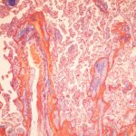 Placenta bandages have way more well being advantages than dangerous placenta capsules − a bioengineer explains Placenta bandages have way more well being advantages than dangerous placenta capsules − a bioengineer explains