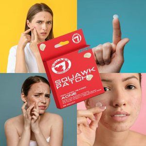 Acne Patch by SQUAWK Brands Cosmetics Original Patch: Hydrocolloid Acne Pimple Patch – Cover Zits and Blemishes with Spot Stickers for Face and Skin (36 Count), Beige
