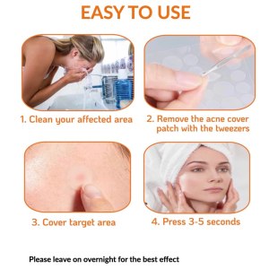 Pimple Patches 180 Count Acne for Covering Zits and Blemishes with 1 Tweezers- Absorbing Cover Patch- Hydrocolloid Invisible-Skin Care- Spot Stickers for Face and Skin-Quick Healing 2 Sizes