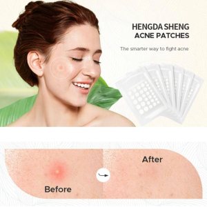 Acne Healing Hydrocolloid Patches, Blemish Treatment, Spot Stickers for Face and Skin (36 Count)