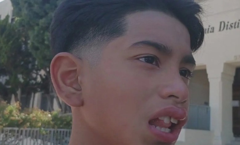 LA teen allegedly beaten by classmate with brass knuckles as bully’s mom watched LA teen allegedly beaten by classmate with brass knuckles as bully’s mom watched