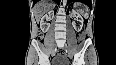 ‘There is a dire lack of … studies’ ‘There is a dire lack of … studies’