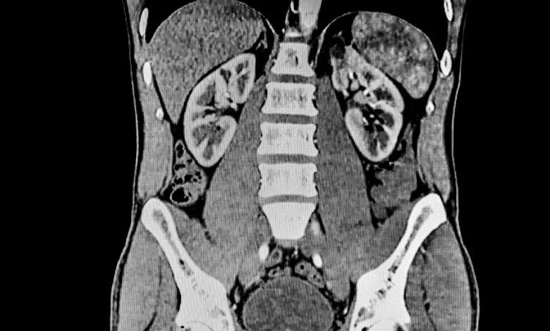 ‘There is a dire lack of … studies’ ‘There is a dire lack of … studies’