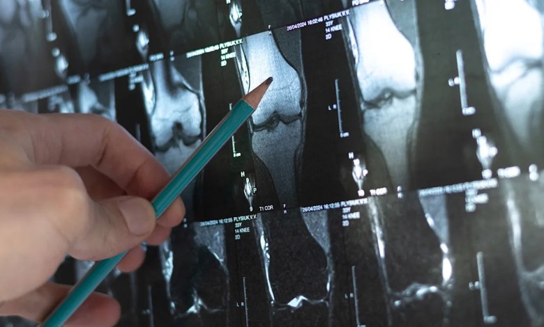 Scientists sound alarm after making unsettling discovery deep in human bones: 'There's a gap in our knowledge' Scientists sound alarm after making unsettling discovery deep in human bones: 'There's a gap in our knowledge'