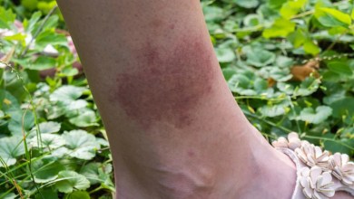 Officials issue warning after finding harmful insects in US region for first time: ‘Unexpected’ Officials issue warning after finding harmful insects in US region for first time: ‘Unexpected’