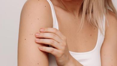 Doctors Say This Overlooked Skin Change Could Mean You’re Eating Too Much Sugar Doctors Say This Overlooked Skin Change Could Mean You’re Eating Too Much Sugar