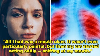 Cancer Patients Reveal The Symptom That Made Them Think Something Might Be Wrong Cancer Patients Reveal The Symptom That Made Them Think Something Might Be Wrong