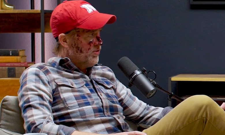 Former Sen. Ben Sasse, Bleeding from His Face, Shares Brutal Reality of Terminal Cancer at Age 54 Former Sen. Ben Sasse, Bleeding from His Face, Shares Brutal Reality of Terminal Cancer at Age 54