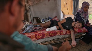 Photos of amputees in Gaza, struggling to survive after losing limbs to Israeli airstrikes Photos of amputees in Gaza, struggling to survive after losing limbs to Israeli airstrikes