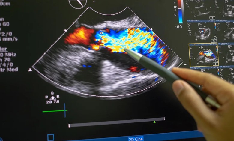 ‘Cause around one in five … deaths’ ‘Cause around one in five … deaths’