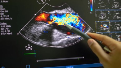 ‘Cause around one in five … deaths’ ‘Cause around one in five … deaths’