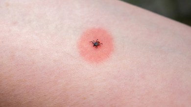 ‘There are no cures yet’ ‘There are no cures yet’