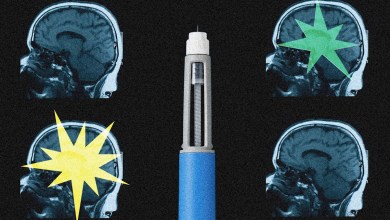 Ozempic may be reshaping the brain, scientists say Ozempic may be reshaping the brain, scientists say