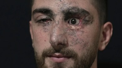 Portraits of survivors of Israel’s pager attack on Hezbollah last year Portraits of survivors of Israel’s pager attack on Hezbollah last year