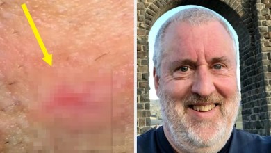 I Had An Itch In A Very Private Spot. Things Turned Tragic After I Asked My Doctor A Simple 4-Word Question. I Had An Itch In A Very Private Spot. Things Turned Tragic After I Asked My Doctor A Simple 4-Word Question.