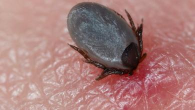 Health officials sound alarm as US region sees surge in dangerous disease: ‘It’s changed my life’ Health officials sound alarm as US region sees surge in dangerous disease: ‘It’s changed my life’