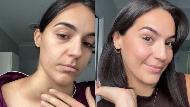 Woman, 26, Had Excessive Itching but Was Told ‘It’s Just One of Those Things.’ She Then Self-Diagnosed Her Cancer (Exclusive) Woman, 26, Had Excessive Itching but Was Told ‘It’s Just One of Those Things.’ She Then Self-Diagnosed Her Cancer (Exclusive)