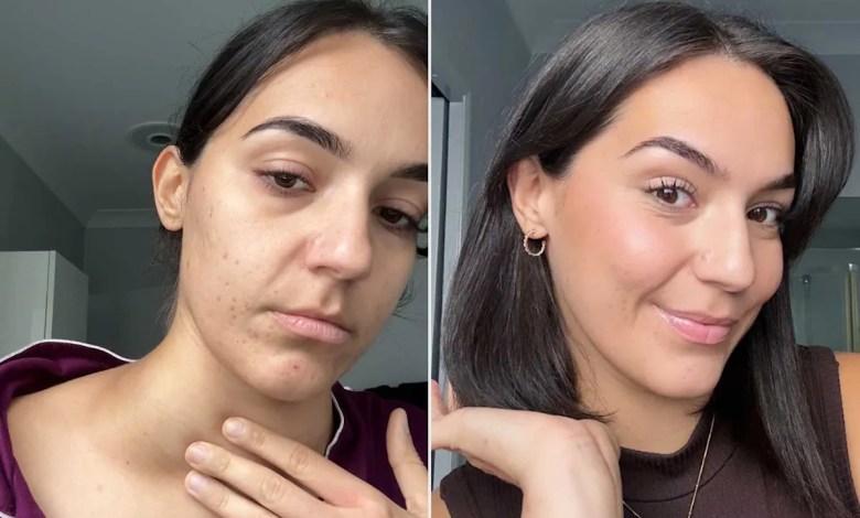 Woman, 26, Had Excessive Itching but Was Told ‘It’s Just One of Those Things.’ She Then Self-Diagnosed Her Cancer (Exclusive) Woman, 26, Had Excessive Itching but Was Told ‘It’s Just One of Those Things.’ She Then Self-Diagnosed Her Cancer (Exclusive)