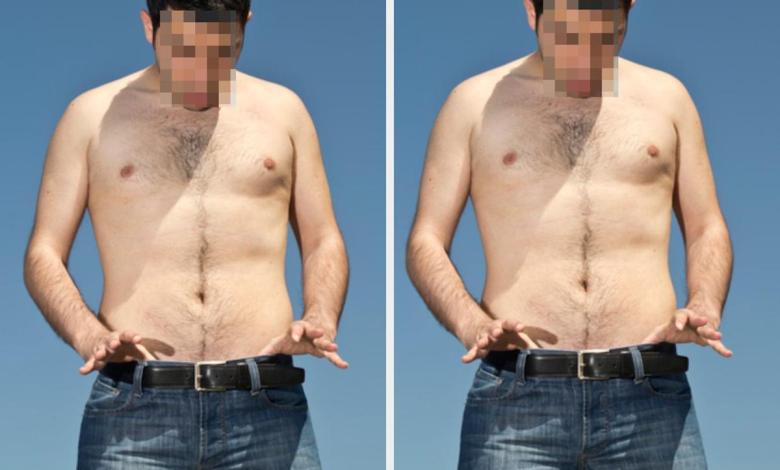 Men Who Have Gotten Vasectomies Are Sharing Their Stories And Some Of Them May Surprise You Men Who Have Gotten Vasectomies Are Sharing Their Stories And Some Of Them May Surprise You