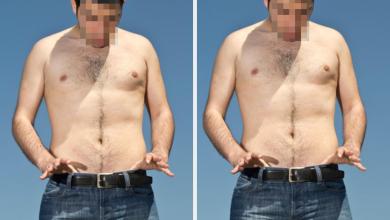 Men Who Have Gotten Vasectomies Are Sharing Their Stories And Some Of Them May Surprise You Men Who Have Gotten Vasectomies Are Sharing Their Stories And Some Of Them May Surprise You