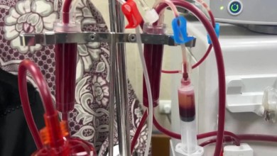 Gazan kidney patients await Monday reopening of border crossing Gazan kidney patients await Monday reopening of border crossing