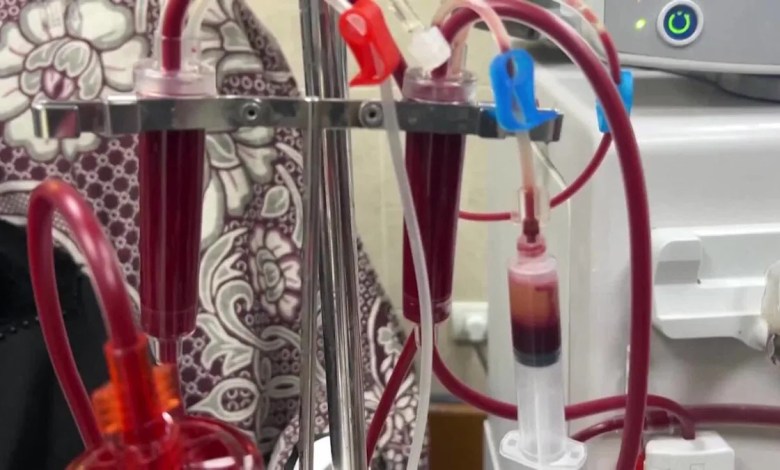 Gazan kidney patients await Monday reopening of border crossing Gazan kidney patients await Monday reopening of border crossing