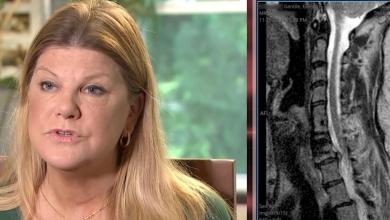 NJ mom was gowned and had an IV in when hospital tried to cancel her surgery. She ended up owing 6K for it NJ mom was gowned and had an IV in when hospital tried to cancel her surgery. She ended up owing 6K for it