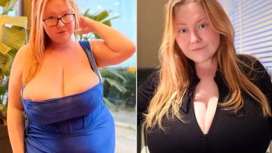 Woman’s 39-Lb. Breasts Won’t Stop Growing Due to a Rare Condition — Which She Discovered While on Mounjaro Woman’s 39-Lb. Breasts Won’t Stop Growing Due to a Rare Condition — Which She Discovered While on Mounjaro